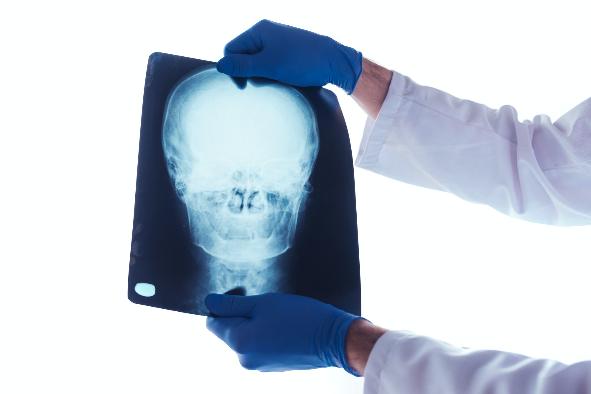 Doctor examining x-ray of the skull